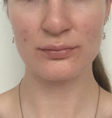 state of skin before usage