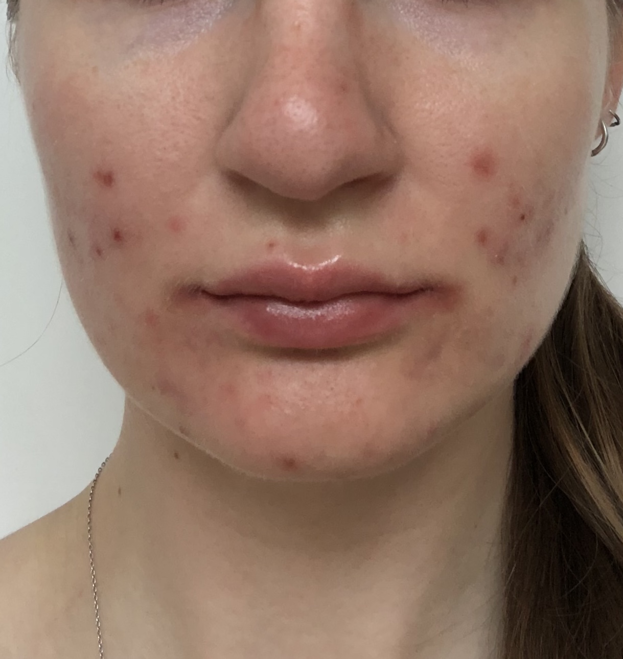 state of skin after usage