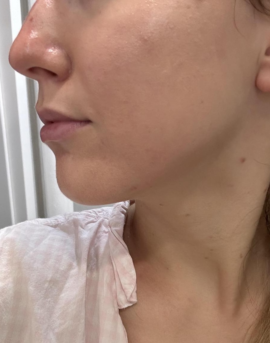 state of skin before usage