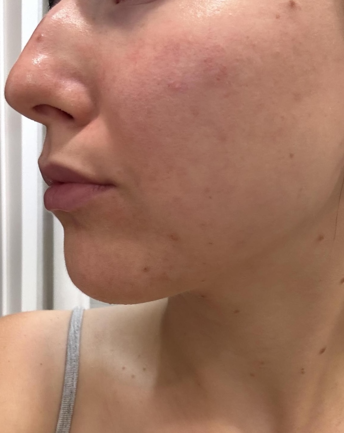 state of skin after usage